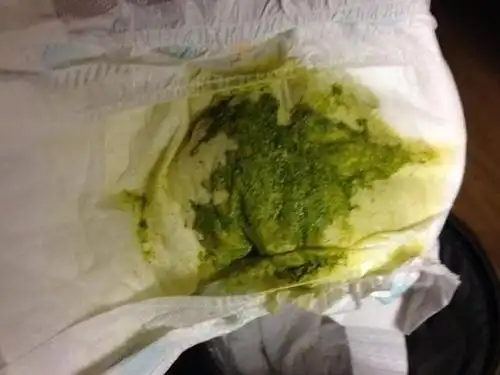 正常的白带是什么样的