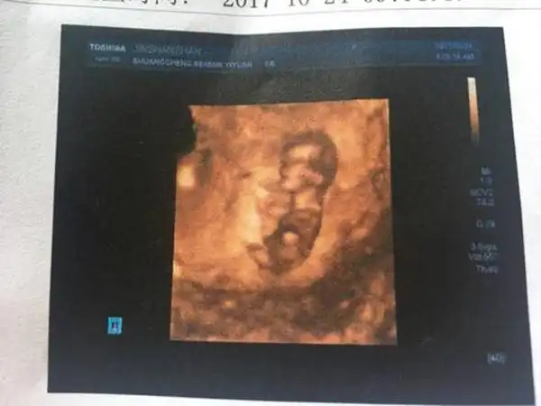 已生女儿 nt 最明显的女宝特征看数据