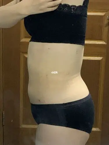 「水动力腰腹环吸」腰围变化不大了 失败