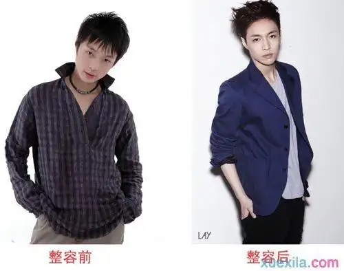 张艺兴整容了吗?