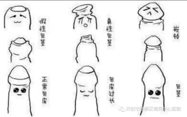 青少年什么是包皮过长包茎为什么建议选择暑假做包皮包茎手术