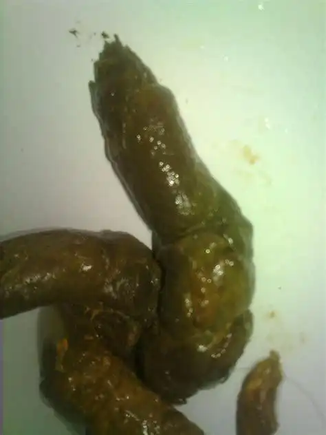 正常的大便颜色形状正常的大便颜色2022已更新今日动态