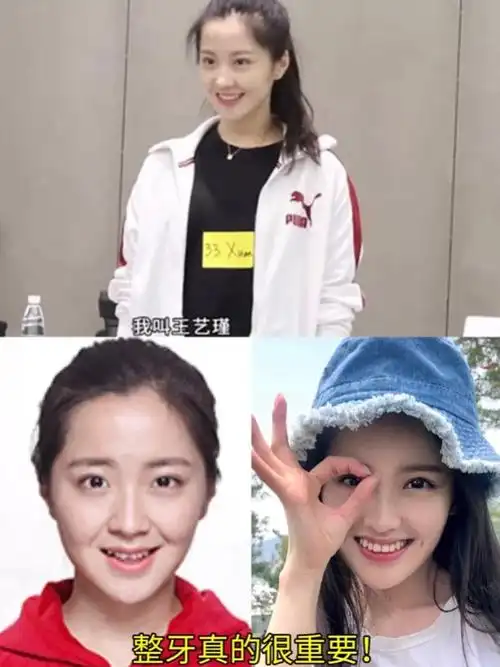 王艺瑾旧照曝光,do这点让她笑容甜度满格