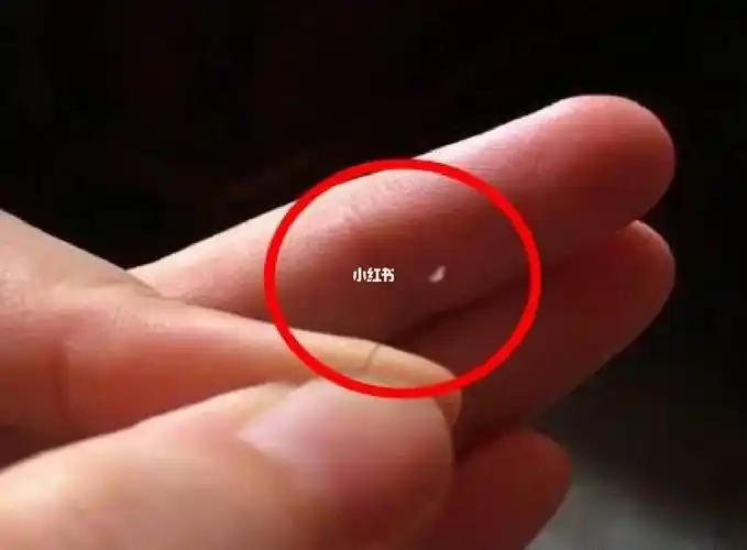 发根处白色颗粒是毛囊