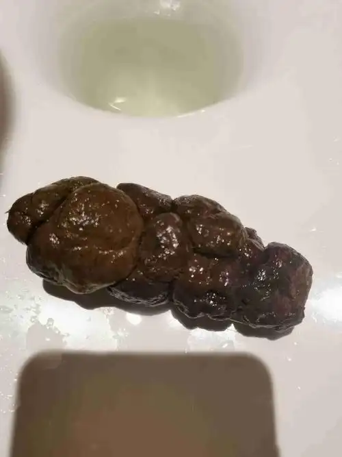 这样的便便健康吗?感觉自己很难每天早上都大便