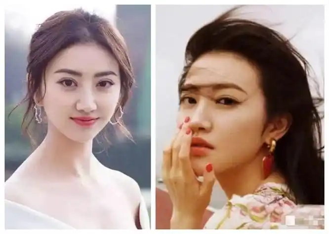 景甜双眼皮修复前后对比图颜值差别太大景甜是怎么修复的