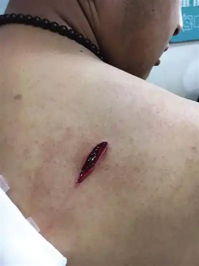 北京通州多人持刀砍伤拆违工人 警方已立案(图)