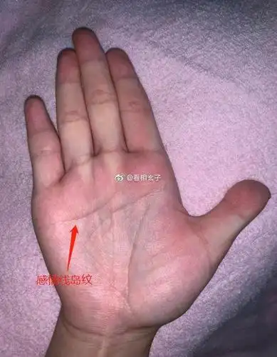 你的手相生命线岛纹,手掌发青,手指泛白,. 来自美食年 - 微博