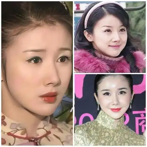 娱乐圈竞争激烈,为了得到更多的机会,不少明星会狠心选择整容让自己更