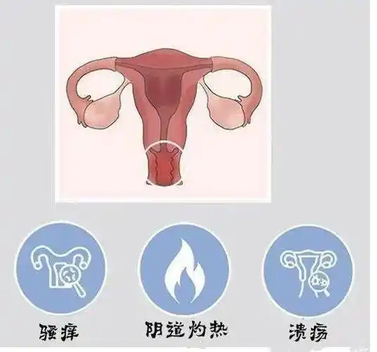 女性_阴道_性生活