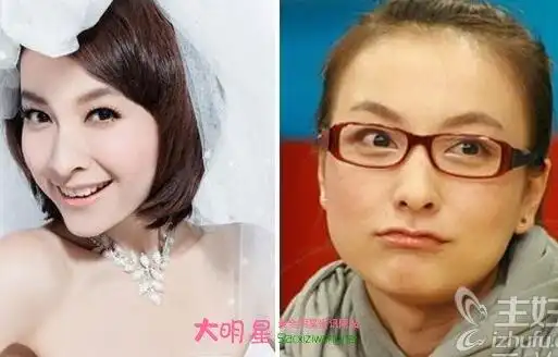 吴昕整容了吗 吴昕整容前后对比照片