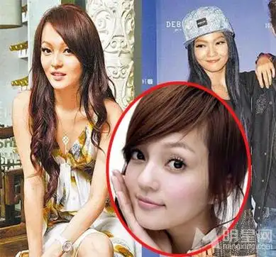 张韶涵脸部变样疑整容 网友力挺坦言人各有志