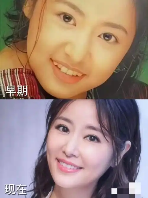 牙齿对一个人的容貌有多重要?看看这些明星的对比图就知道了.