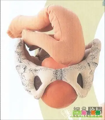 顺产时宝宝入盆和娩出的一些形象图片