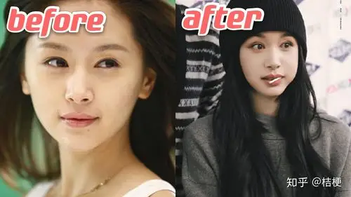 王子文填充后越来越少女了最会填充的女明星