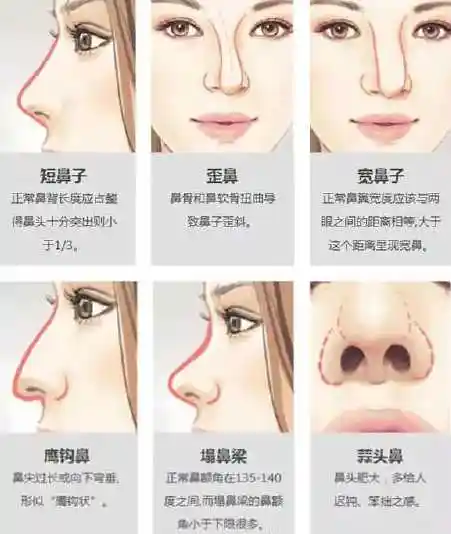 在你们眼中低鼻梁就没有好看的吗?