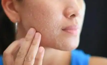 冬季皮肤干燥,上妆不服帖怎么破?