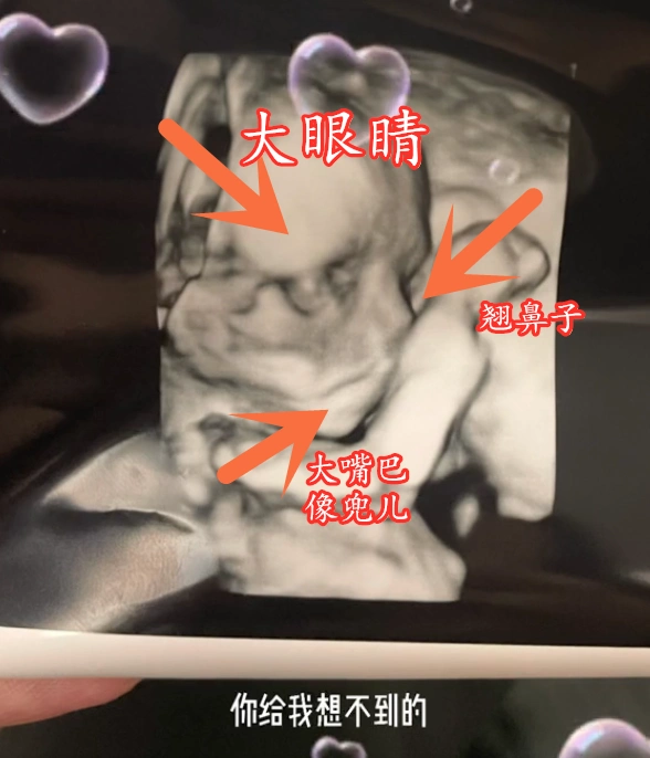 小猪先生兜儿晒孩子四维图大眼睛高鼻梁大嘴巴比小猪妹强多了