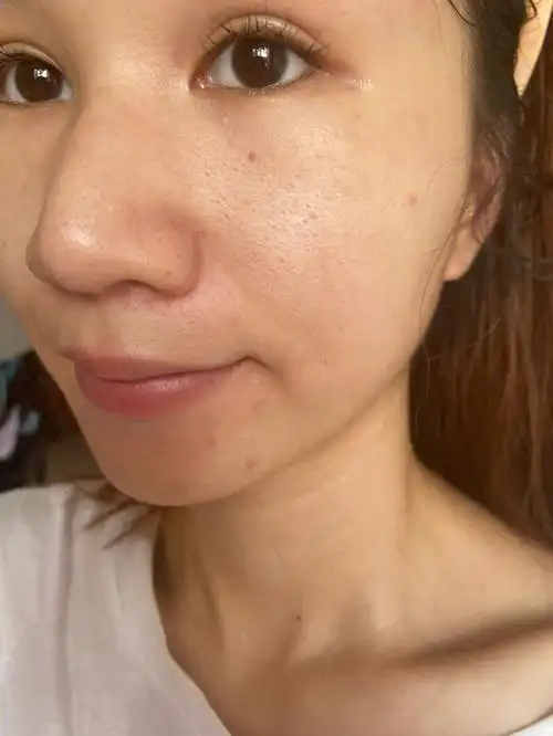 今天睡醒的皮肤状态 哇靠 真不错