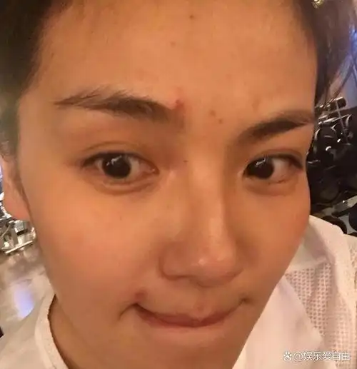 13位女星素颜名场面!"浮肿油腻,憔悴老态",好像瞬间老了十岁