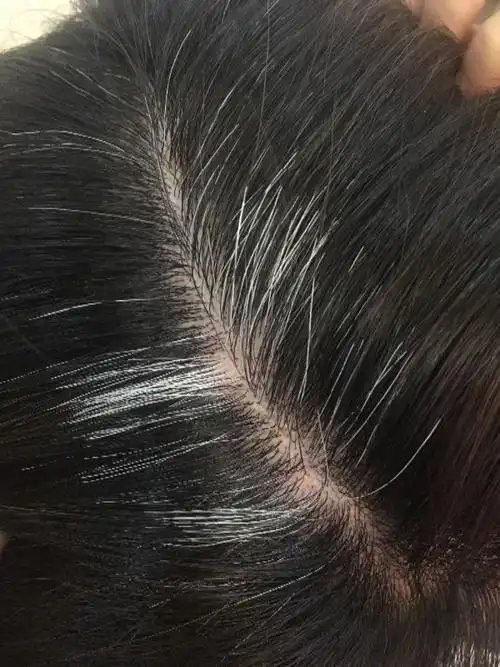 为什么白头发越长越多?不要认为自己老了,你可能是缺这几种东西