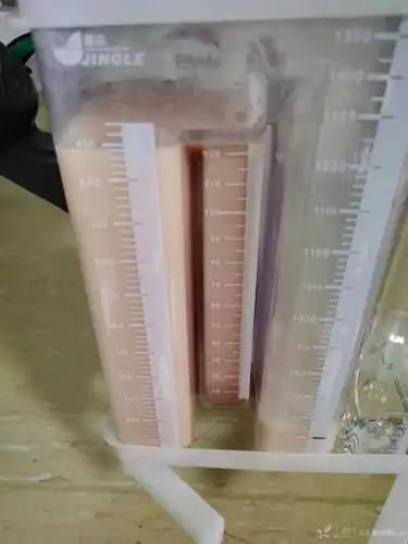 61 岁男性外伤后右侧流出「牛奶」胸水,病因竟是?_乳糜