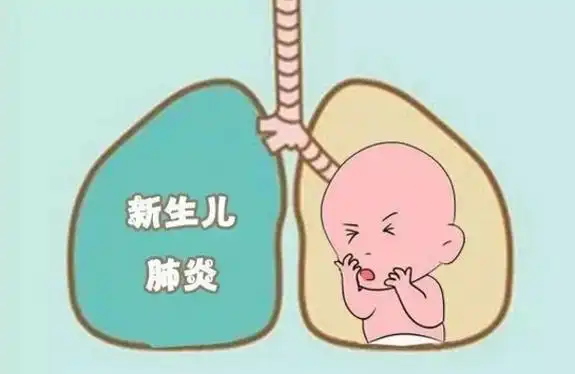 儿童健康新生儿常见疾病新生儿肺炎
