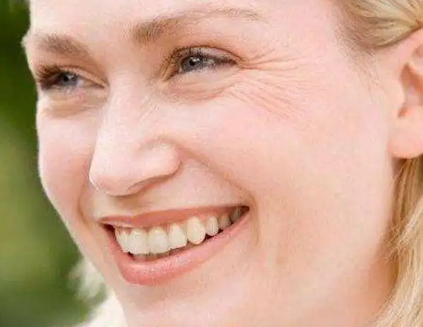 女性若想远离皮肤松弛建议做好3件事不妨了解一下