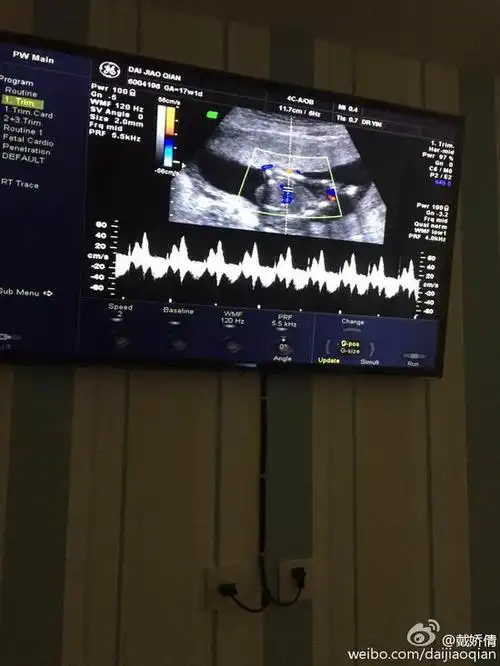 1月18日上午,戴娇倩[微博]在微博承认已怀孕,并晒出肚中baby的b超照