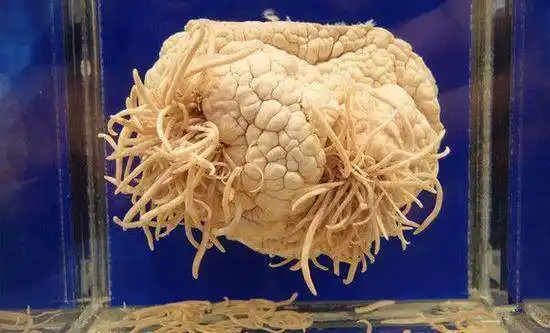 女子乳房里取出3条活虫,医生取出时身躯还在蠕动,只因爱喝生水