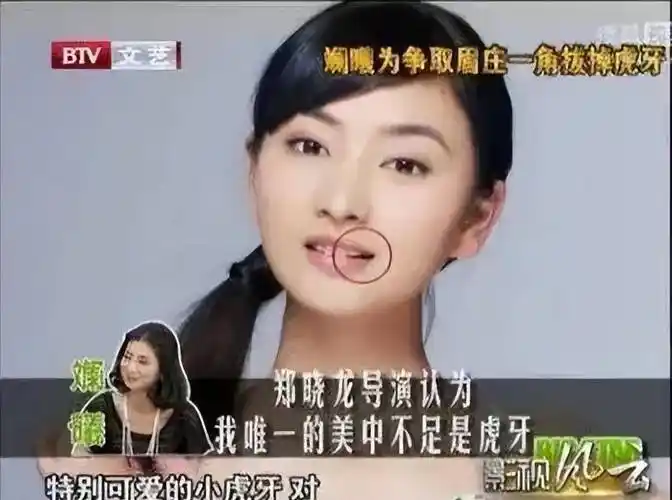 26,斓曦为了饰演温婉端庄的沈眉庄,去口腔医院跑了十多次,最后还是把