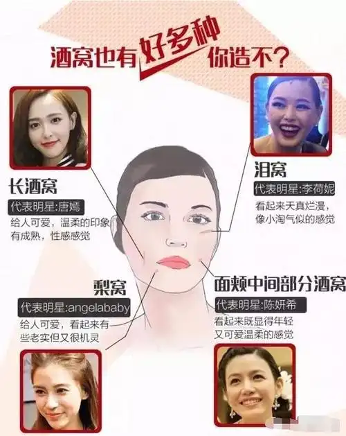 85的姑娘都想要酒窝戳进来了解酒窝成形术你是属于哪种酒窝
