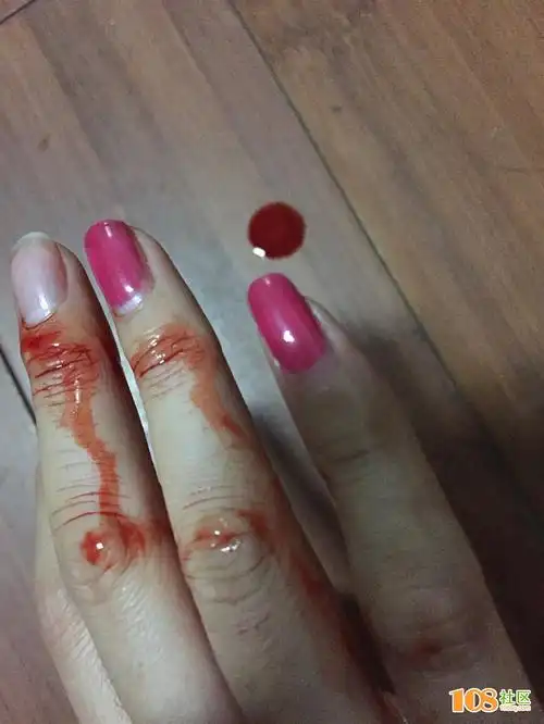 长兴女子惨遭数次家暴,被老公用刀割伤血淋淋!