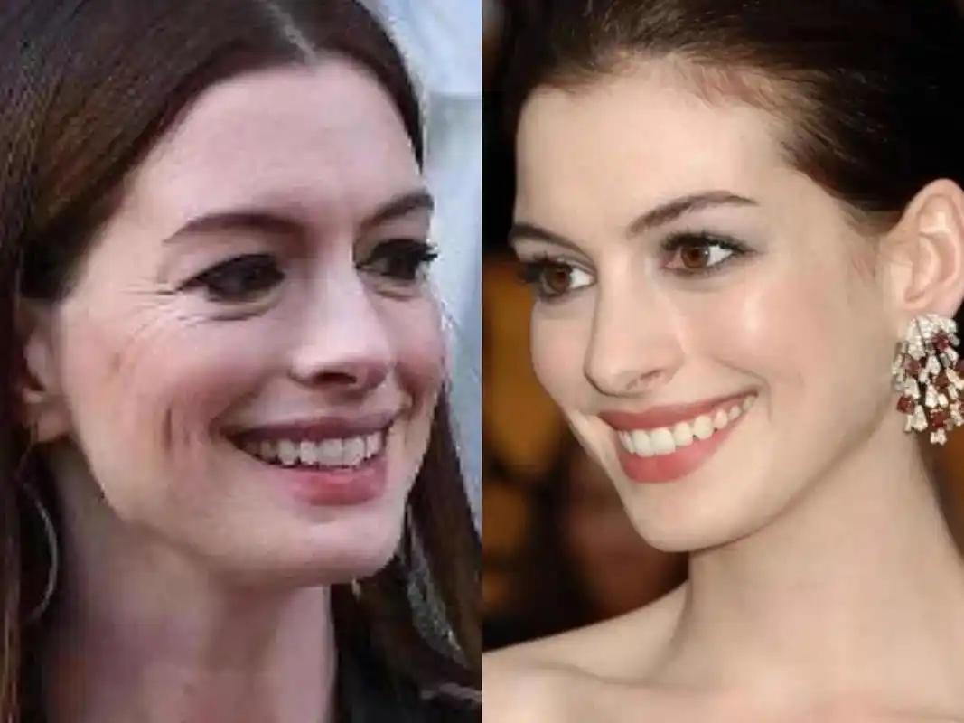 明星大把花钱做保养,也无法完全抗衰老,这事有解么?