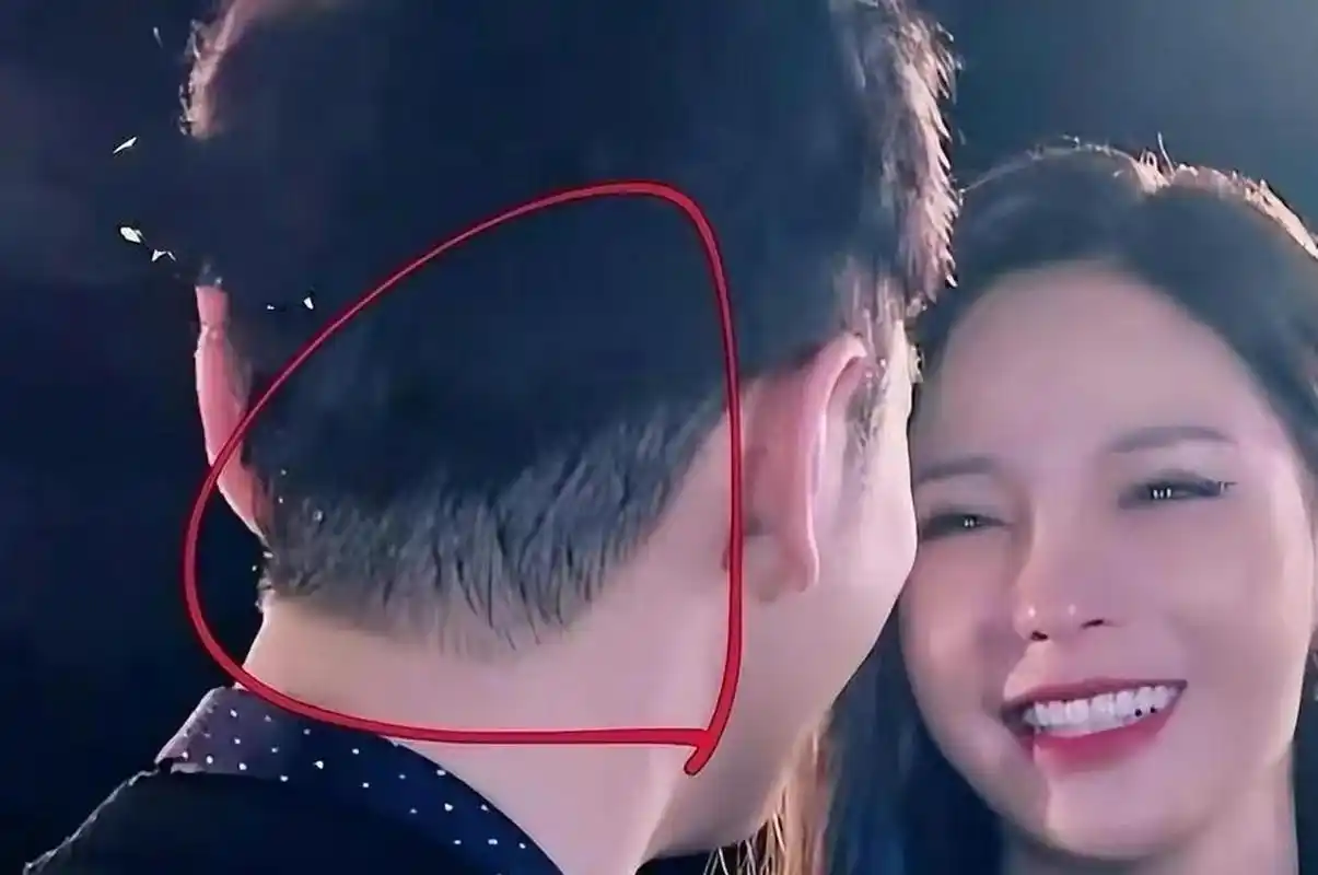 怀疑黄晓明植发了,但并没有直接证据,毕竟黄晓明四十多岁的人,竟然