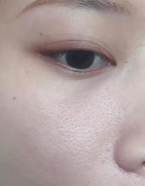 脸上毛孔粗大有什么方法修复?这几个小技巧,简单在家就能做!