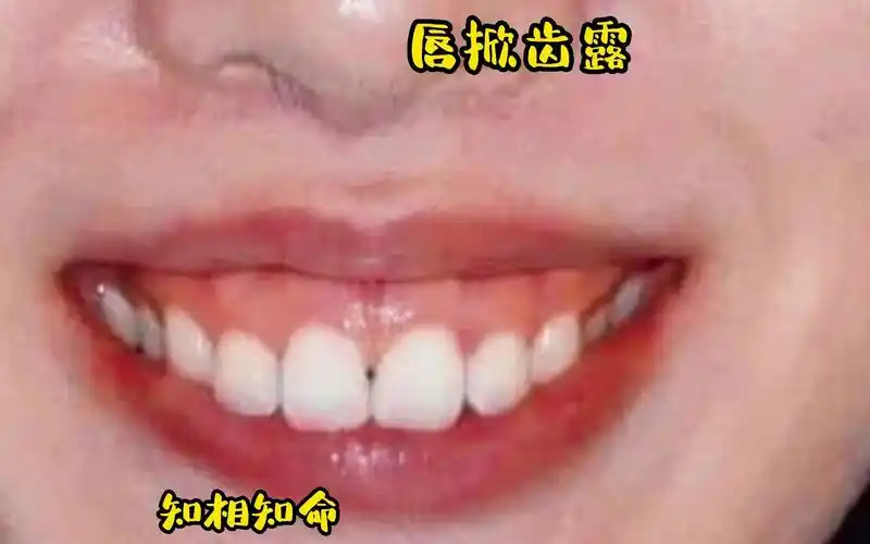 识人有术,唇掀齿露