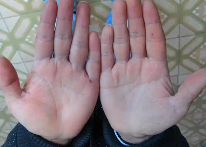 男左手断掌,附图片,求大仙真言,不懂的,不信的,观众即可