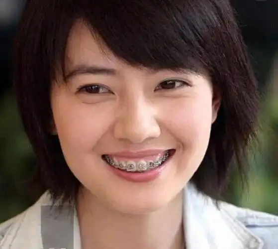 此外如果你的牙齿足够整齐漂亮,那么你就可以在很大程度上提高你的