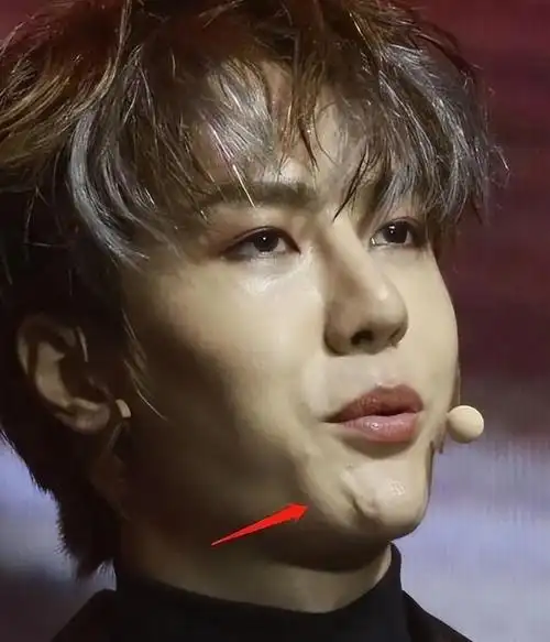 8位"改头换命"的男明星,王一博脸已僵硬,刘恺威眼皮才是灵魂_网易订阅