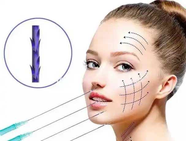 可以解决哪些问题?面部线雕术后注意事项你要知道