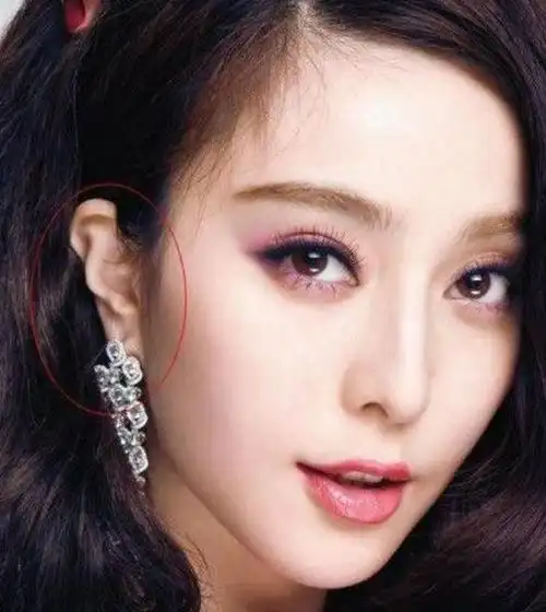 娱乐圈里的残疾人,吴京断手指,范冰冰耳朵外翻,而她因手上热搜