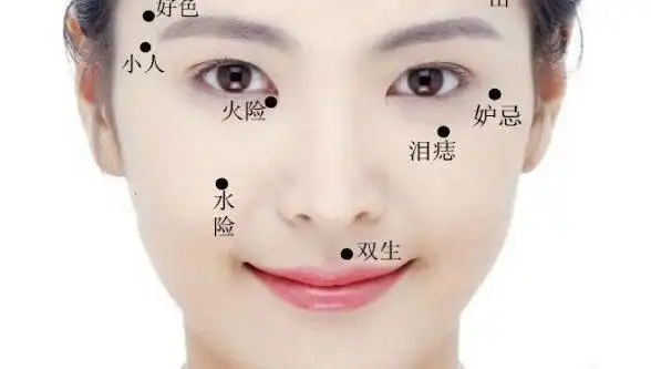 这4个部位长"痣",一生财运相随