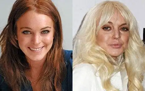 盘点整容失败的影视星巨 后果超恐怖