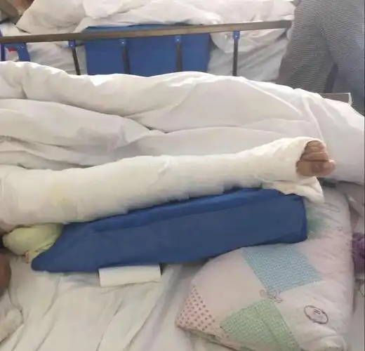 大哥失踪二哥截肢残疾小妹活成顶梁柱