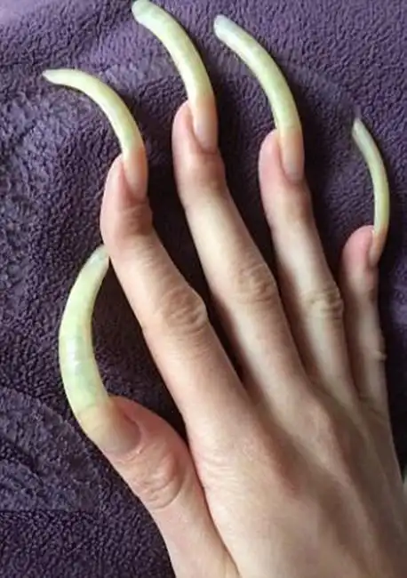 德国女孩喜留长指甲已经三年未剪最怕洗澡与穿衣