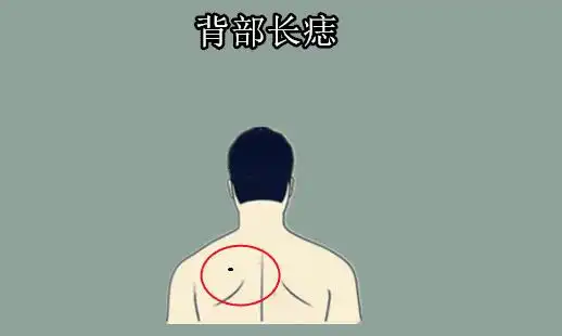 身体有这5颗痣,早晚会取得成功,一辈子都不用为钱发愁担心_的能力