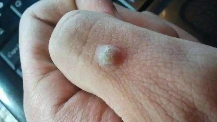 开塞露滴到茶水里,解决了多数女性朋友的烦恼,实用又省钱