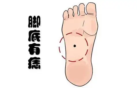 痣相一:脚底有痣研学旅行联盟中心研学旅行联盟中心,是三亚康泰旅行社