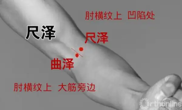 将手臂上举,在手臂内侧中央处有粗键,键的外侧即是此穴(或在肘横纹中